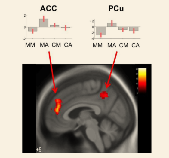 The two charts show activity in two parts of the DMN, the  anterior cingulate cortex (ACC, in the left graph) and the dorsal precuneus (PCu, in the right graph).  The four bars show the activity for meditators meditating (MM), meditators performing the active task (MA), and the same two things for the controls meditating (CM) and performing the active task (CA).  The meditators show decreased DMN activity during meditation, which flips to positive activation during the active task.  No such trend is seen for the controls.  This is indicative that the brains of meditators show fundamentally different responses to stimuli than the brains of non-meditators.